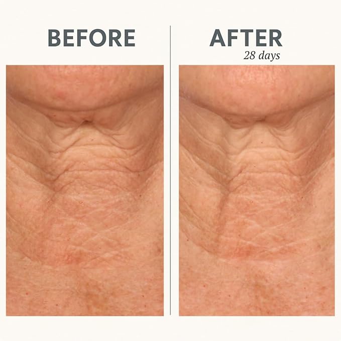 Serious Skincare Reverse Lift CORREC-CHIN IN-TENSE Firming Treatment Cream, for Tightening Double Chin, Neck, Jawline, Anti-Aging Moisturizer, Firming Skin Care 1.7 oz