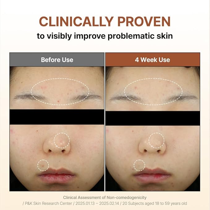 [BY WISHTREND] Mandelic Acid 5% Skin prep Water, Gentle Skin Korean exfoliator for face, Aha Bha Toner, Ideal for Sensitive Skin (5.1 Fl Oz (Pack of 1))