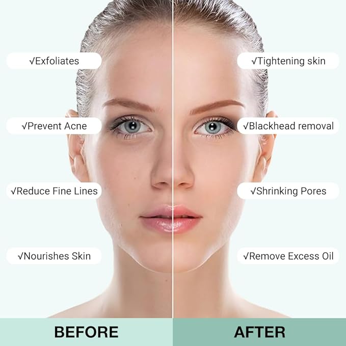 Clay Mask For Face Skincare, Blackhead Remover Face Mask with Mugwort Extract, Deep Pore Cleansing, Moisturizing, Skincare Facial Mask for Refining Pores and Controlling Oil, 40g/1.35oz