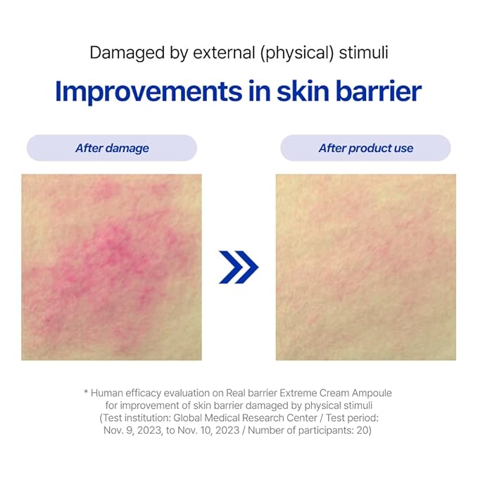 Real Barrier | Extreme Cream Ampoule | Face Serum for Dry Skin | Skin Barrier Repair & Strengthening Facial Serum | Moisturizing Skin Care for Sensitive Skin | Korean Skin Care | 1.96 fl oz (50ml)