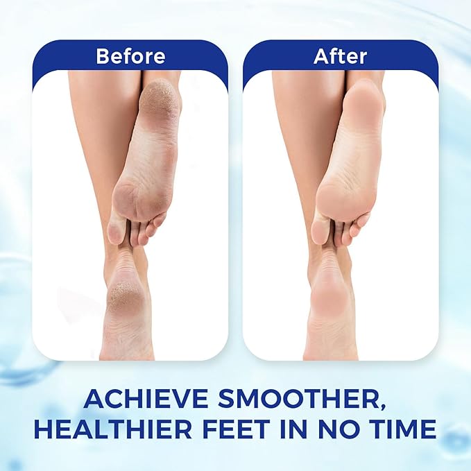 OUKEYA Urea Cream 42 Percent for Foot & Hand Cream with Foot Files for Dry Cracked Urea Lotion for Feet Maximum Strength Foot Cream for Dry Cracked Treatment