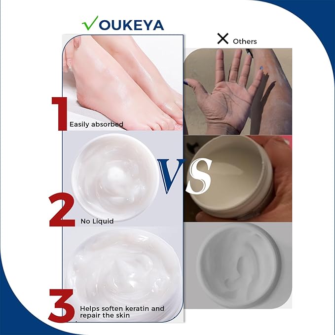 OUKEYA NEW FORMULA Urea Cream 40 Percent for Feet Maximum Strength, Hand Heels Dry Cracked Treatment Lotion for Knees & Elbows, Foot Dead Skin Cuticle Callus Remover Toenail Softener, 5.29 oz