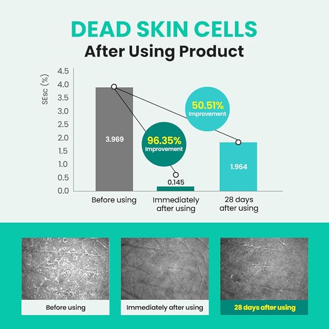 Real Barrier | Porebium Peeling Toner | Face Toner for Blackhead Control | Dead Skin Cells Exfoliator for Sensitive Skin | No Sebum Solution for Oily Skin | Korean Skincare |10.31 fl oz (305ml)