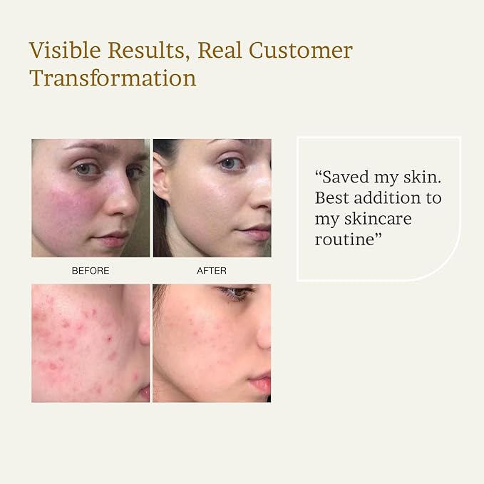 HydroFlora Barrier Repair Face Oil Gel– Lightweight, Non-Greasy Facial Oil for Women with Vitamin E, Bakuchiol & CoQ10 for Deep Hydration & Skin Barrier Support