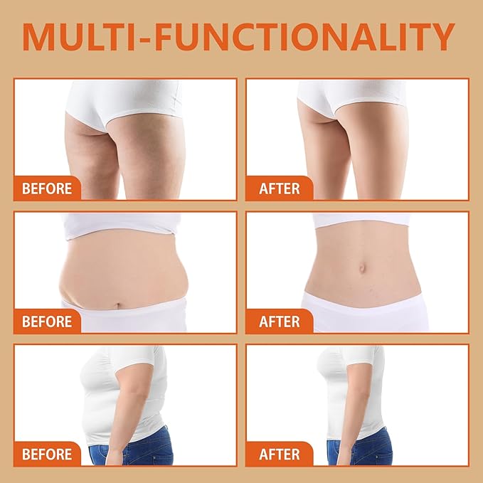 Anti Cellulite Massage Oil & Hot Cream Set with Massager, Natural Cellulite Remover, Oil & Massager for Legs Arms and Butt, Firm, Tighten & Moisturize Skin Soothes Muscles (8 Fl Oz)