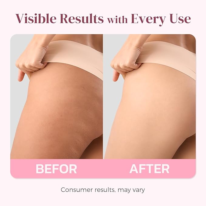 Cellulite Cream Booty Tight Lift and Firm - Smooth & Sculpt Booty, Thighs, Belly & Arms | LIFTONIN® Skin Firming & Toning Bum Mask 3.72 fl oz
