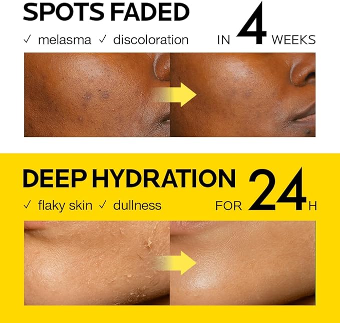 MIMUMIMU Dark Spot Remover Toner for Face | Korean Clinic Skincare - Thioctic Acid & Niacinamide 5% | Fades Melasma & Hyperpigmentation | Gentle Exfoliation w/Pumpkin Extract | Pack of 4