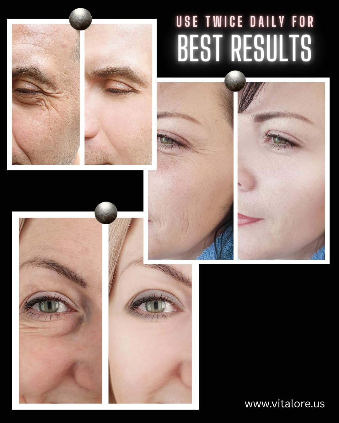 Collagen & Retinol Anti-Aging Face Cream with Hyaluronic Acid