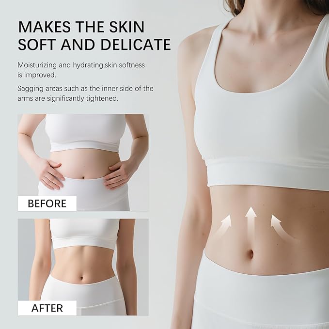 New Champagne Moisturizing Firming Body Creme for Hydrating, Skin Moisturizer Tightens, Hydrates Dry Skin on Arms, Legs, Belly & Neck - Day and Night - 1 Pack (Coconut, 8 Fl Oz/236 ML)