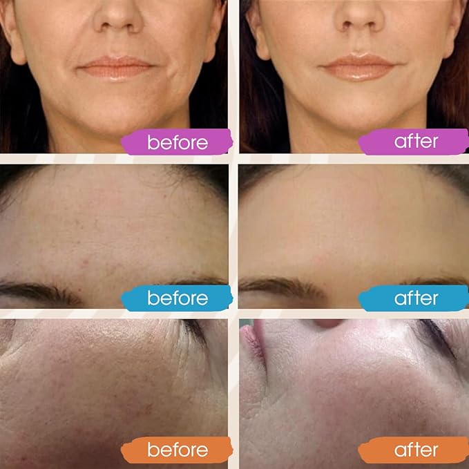 GLEOW Retinol Serum for Face, Vitamin C with Hyaluronic Acid Face Serum for Women and Men, Glow Total Package Skin Care Set, Targets Appearance of Uneven Skin Tone and Dryness 3x2 oz