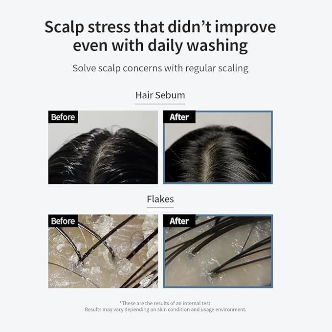 GROWUS Sea Salt Therapy Scalp Scaler - Salicylic Acid, Niacinamide, Dexpanthenol, Exfoliating, Deep Cleansing, Free from Paraben and Sulfate, 2 in 1 Shampoo for Itchy and Oily Scalp (8.8 Oz / 250g)