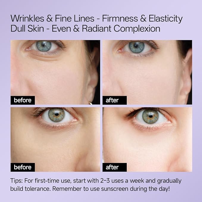 WNP Gentle Retinol Cream for Sensitive Skin, 10×Deep Transdermal Night Cream Anti-Aging Face & Neck Moisturizer with Ceramides, Peptides, Pro-Xylane, Wrinkle Cream for Fine Lines, Firming, Hydrating