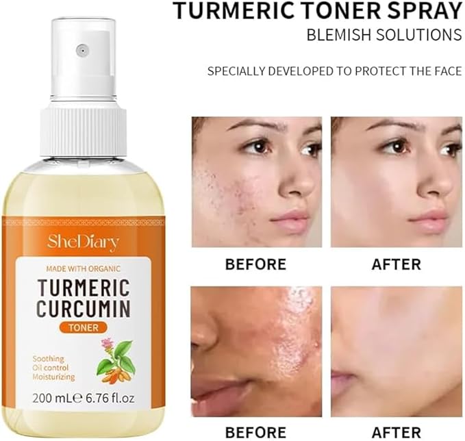 Turmeric Toner Spray Calming Hydrating Soothing Oil Control Moisturizing Face Mist (1)