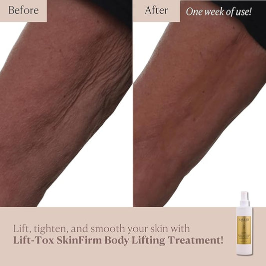 Nakery Lift-Tox SkinFirm Spray, Skin Tightening Cream for Body, Firming Body Lotion Instantly Lifts Saggy Areas & Smooths Cellulite, Crepey Skin Repair, Clinically Proven Body Lifting Treatment
