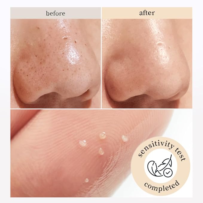 NOONI Facial Cleanser – Snow Aqua 0 Rice Ceramide Barrier Care Cleansing Oil | Makeup Remover, Face Wash, Face Oil Cleanser, Pore Care, Korean Skin Care, Vegan, 6.76 fl oz (200ml)