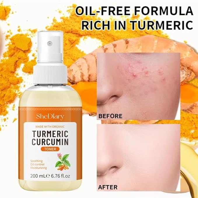 Turmeric Toner Spray Calming Hydrating Soothing Oil Control Moisturizing Face Mist (1)