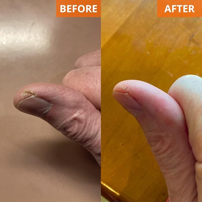 Yu-Be Moisturizing Skin Cream 4.4 Fl. Oz. Jar I Deeply Hydrating Non-Greasy Moisturizer for Severely Dry Skin I Soothing Camphor Calms, Cools, & Relieves Skin I Vitamins Repair & Nourish