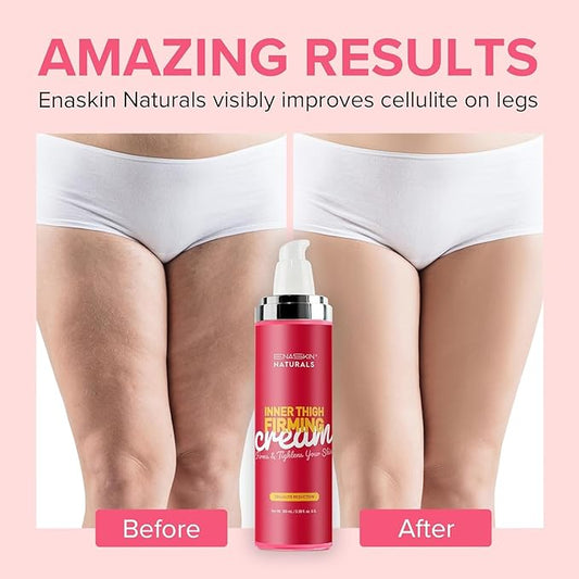 Enaskin Naturals Cellulite Remover for Legs & Anti Cellulite Cream - Skin Firming and Tightening Lotion for Inner Thigh ,Booty, Stomach & Belly, Body Firming Cream for Loose Skin, 100 ML