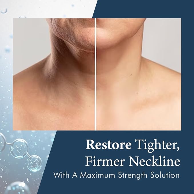 SkinPro Neck Firming and Tightening Cream - Neck Cream with Retinol and Marine Collagen - Anti Aging, Tighten and Lift Cream for Saggy Skin and Turkey Neck