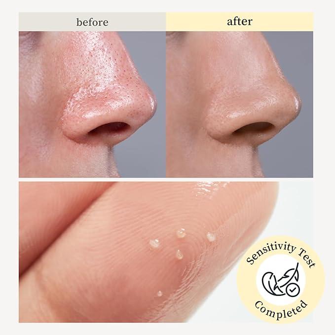 NOONI Facial Cleanser - Snow Aqua 0 LHA Toning Cleansing Oil *2ea | Makeup Blackhead Remover, Pore Control, Glass Skin, Help Control Sebum, Revitalizing, Mother's Day, 6.76 Fl Oz x 2