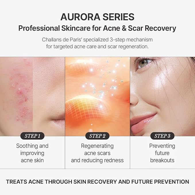 [CHALLANS de PARIS] Ampoule d’Aurora Excellence – Soothing & Balancing Skin-Barrier Support Serum with Niacinamide, Oligo-HA & Ceramide | Lightweight Watery, Hydrating Korean Skincare, 1.23 fl oz