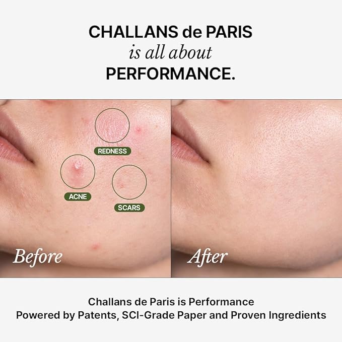 [CHALLANS de PARIS] Ampoule d’Aurora Excellence – Soothing & Balancing Skin-Barrier Support Serum with Niacinamide, Oligo-HA & Ceramide | Lightweight Watery, Hydrating Korean Skincare, 1.23 fl oz