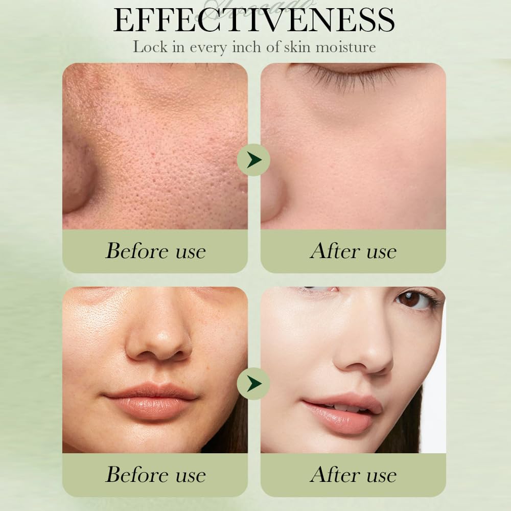 7-Piece Avocado Skincare Gift Set – Hydrating & Anti-Aging Face Care Kit with Cleanser, Toner, Serum, Cream, Eye Cream & Lip Balm – Perfect for Women & Teen Girls 🎁🌿