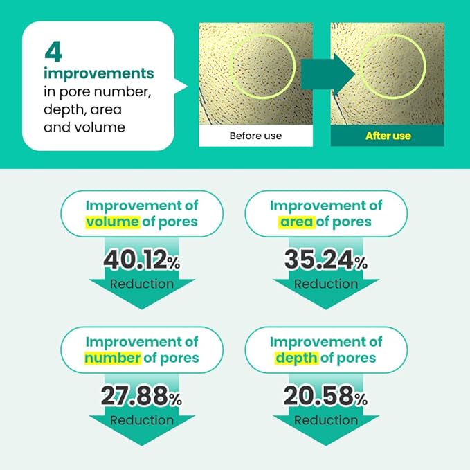 Real Barrier | Porebium Peeling Toner | Face Toner for Blackhead Control | Dead Skin Cells Exfoliator for Sensitive Skin | No Sebum Solution for Oily Skin | Korean Skincare |10.31 fl oz (305ml)