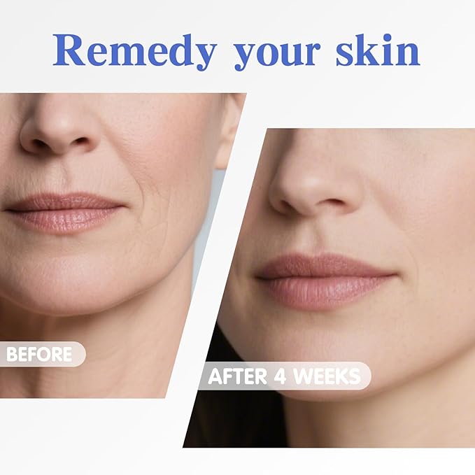 Neck Firming Cream | Face Moisturizer for Women - Anti Aging Formula for Tightening and Firming with Retinol,Collagen,Hyaluronic Acid | Day & Night Moisturizer Suited for Most Skin Types,1.7 OZ