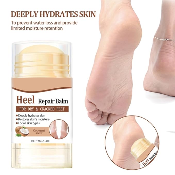 60% Urea Cream - 1.41 oz Coconut Foot Hand Cream Stick for Dry & Cracked Feet Elbows Knees Heels Hands, Hydrates & Nourish Foot Care for Softening and Moisturizing, Removing Calloused Skin
