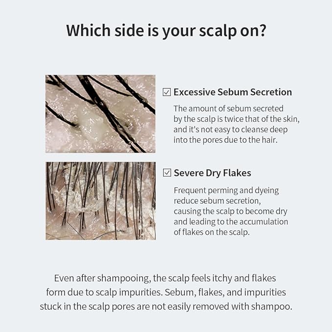 GROWUS Sea Salt Therapy Scalp Scaler - Salicylic Acid, Niacinamide, Dexpanthenol, Exfoliating, Deep Cleansing, Free from Paraben and Sulfate, 2 in 1 Shampoo for Itchy and Oily Scalp (8.8 Oz / 250g)