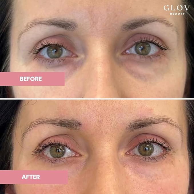 Hydrate & Brighten Eye Cream - Anti-Aging Under Eye Cream for Dark Circles, Wrinkles & Puffiness - With Retinyl Palmitate, Sodium Hyaluronate & Niacinamide - All Skin Types