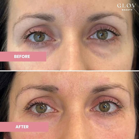 Hydrate & Brighten Eye Cream - Anti-Aging Under Eye Cream for Dark Circles, Wrinkles & Puffiness - With Retinyl Palmitate, Sodium Hyaluronate & Niacinamide - All Skin Types