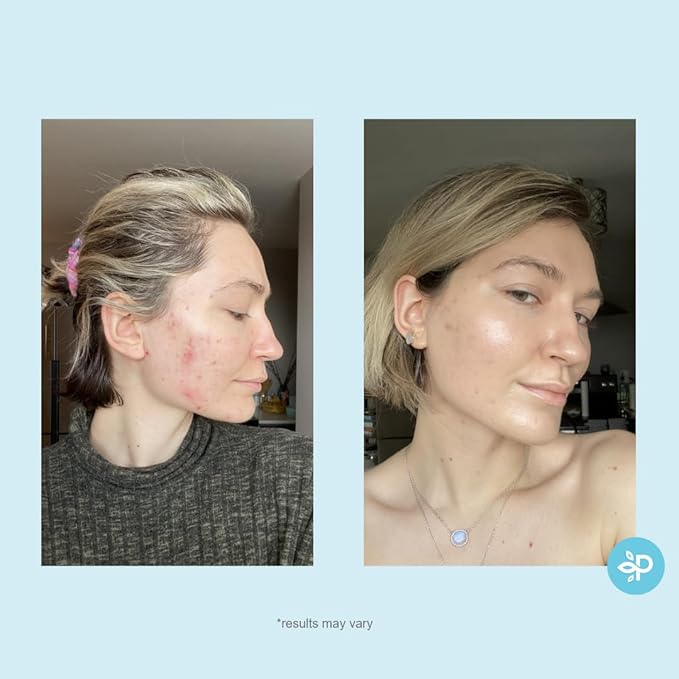 Hydro-Glo Peel Pads - Enhanced with Kojic, Mandelic, Glutathione, Licorice, Papaya, Pineapple, Bearberry Extracts (10% Strength Peel)