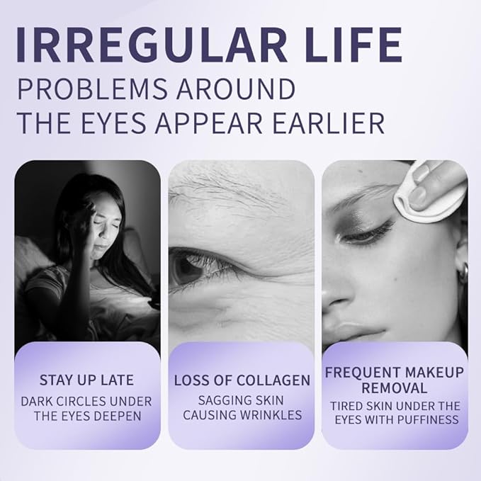 Retinol Vitamin C Eye Cream & Serum Set for Anti-Aging Treatment - Gentle Formula for Sensitive Skin (30g/1 OZ and 8ml/0.27 OZ)