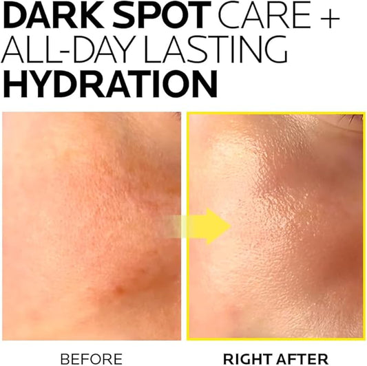 MIMUMIMU Dark Spot Remover Toner for Face | Korean Clinic Skincare - Thioctic Acid & Niacinamide 5% | Fades Melasma & Hyperpigmentation | Gentle Exfoliation w/Pumpkin Extract | Pack of 4