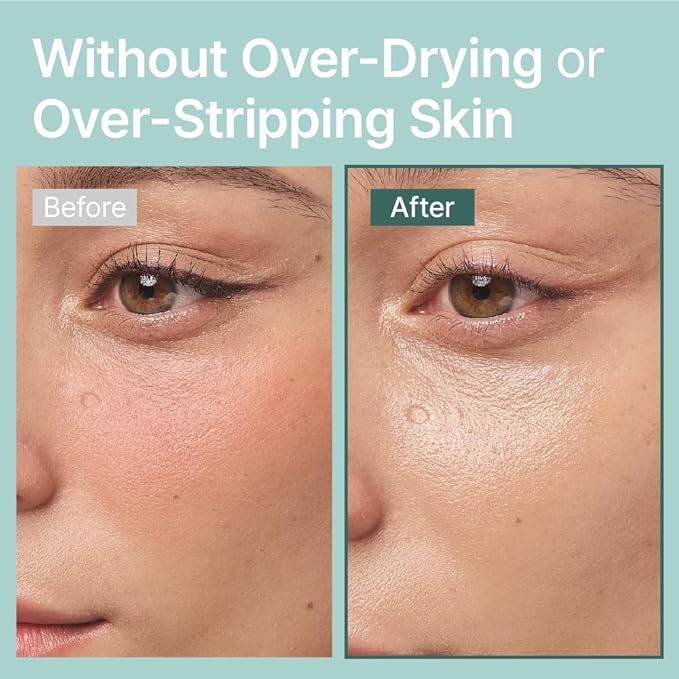 Illiyoon Gentle Deep Facial Cleanser | Low pH Gel-to-Foam Face Wash for Sensitive Skin, Hydrating Gel Cleanser & Daily Makeup Remover, Korean Skincare, 8.45 fl.oz.