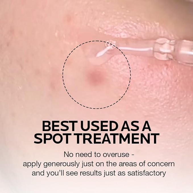 MIMUMIMU Dark Spot Remover Serum for Face | Korean Clinic Skincare - Thioctic Acid 0.01% & Niacinamide 5% | Spot Treatment for Melasma, Hyperpigmentation, Discoloration, Acne Scars | Pack of 2