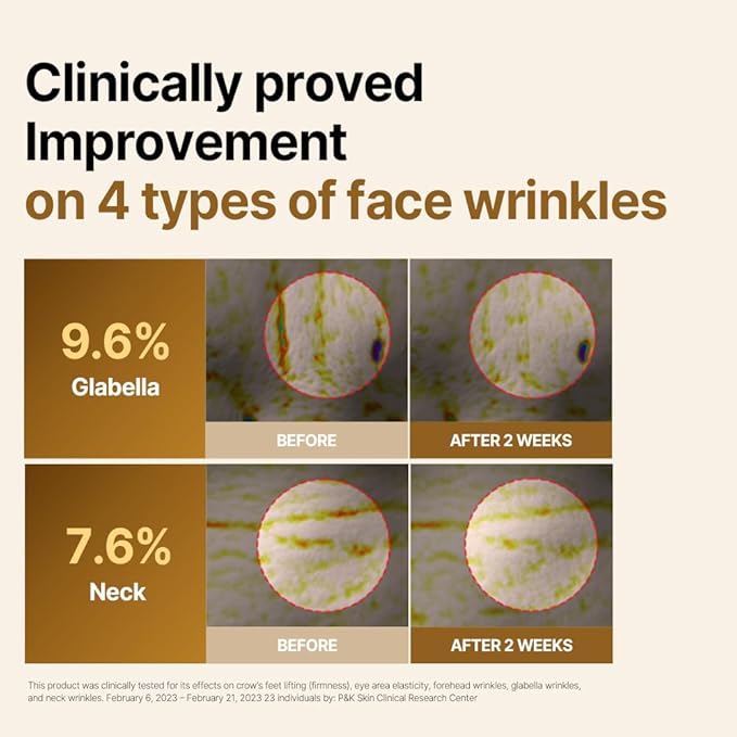 ISOI Intensive Lifting Gua Sha Ampoule Stick, Eye Roller, Under Eye Serum for Dark Circles, Puffy Bags, and Wrinkles with Bulgarian Rose Oil & Peptide Complex, Korean Skin Care (1 fl.oz, 15mlx2)