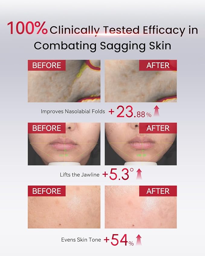 AMIRO PDRN Face Serum – High-Potency Salmon DNA Ampoule with Nano Liposome Technology, Skin Firming & Hydrating Essence – Must Be Used with AMIRO Microcurrent Facial Device – 0.04 fl.oz x 30