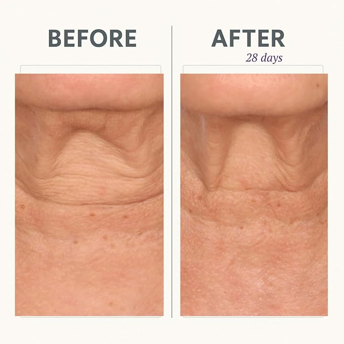 Serious Skincare Reverse Lift CORREC-CHIN IN-TENSE Firming Treatment Cream, for Tightening Double Chin, Neck, Jawline, Anti-Aging Moisturizer, Firming Skin Care 1.7 oz