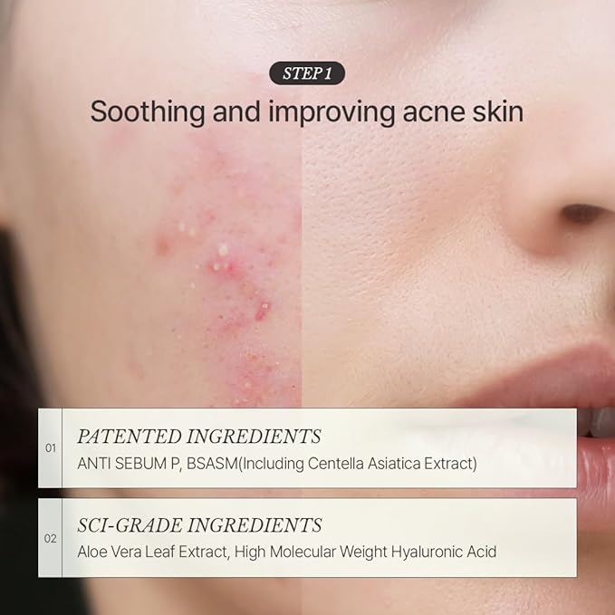 [CHALLANS de PARIS] Ampoule d’Aurora Excellence – Soothing & Balancing Skin-Barrier Support Serum with Niacinamide, Oligo-HA & Ceramide | Lightweight Watery, Hydrating Korean Skincare, 1.23 fl oz