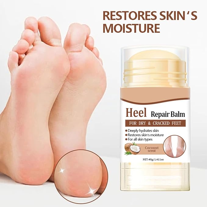 60% Urea Cream - 1.41 oz Coconut Foot Hand Cream Stick for Dry & Cracked Feet Elbows Knees Heels Hands, Hydrates & Nourish Foot Care for Softening and Moisturizing, Removing Calloused Skin