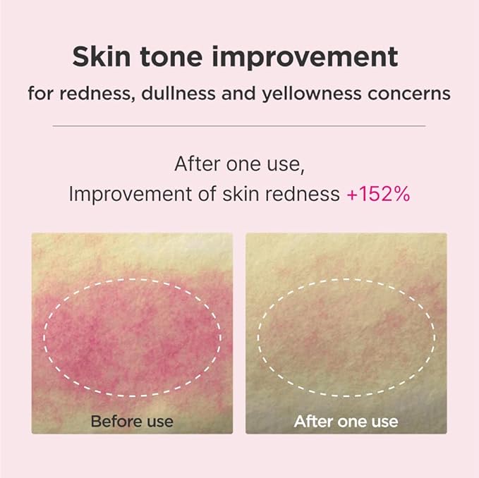 ISOI Blemish Care Up Serum Gift Set, Korean Skin Care Set for Hydration & Radiance – Full Size or 5-Step Travel Kit Options (5-Step Special Kit (1.77 fl. oz))