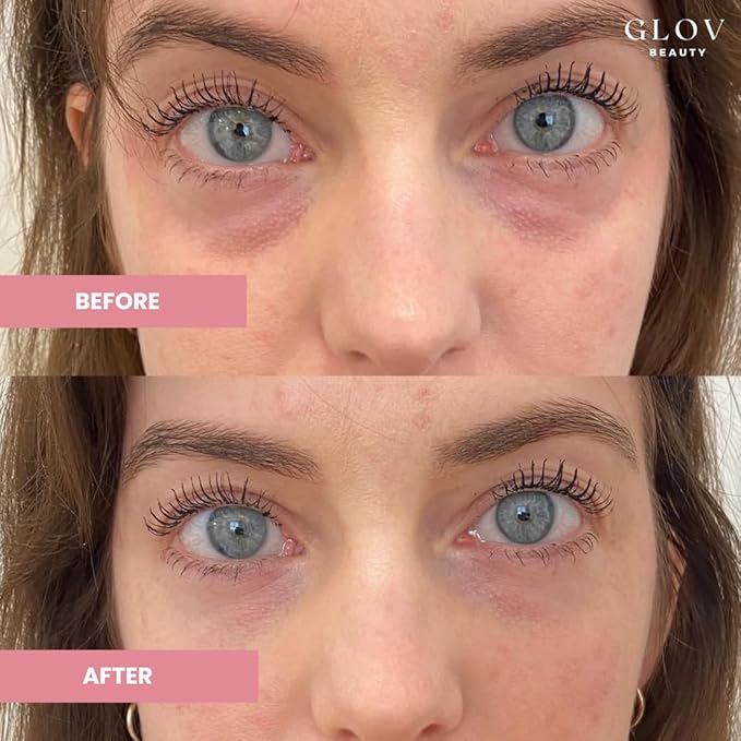 Hydrate & Brighten Eye Cream - Anti-Aging Under Eye Cream for Dark Circles, Wrinkles & Puffiness - With Retinyl Palmitate, Sodium Hyaluronate & Niacinamide - All Skin Types