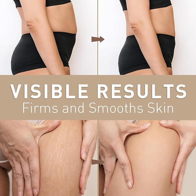 Belly Firming Cream for Tightening & Cellulite – Skin Tightening Cream for Stomach, Thighs & Butt – Moisturizing & Lifting Body Lotion for Women - 4.06 Fl Oz