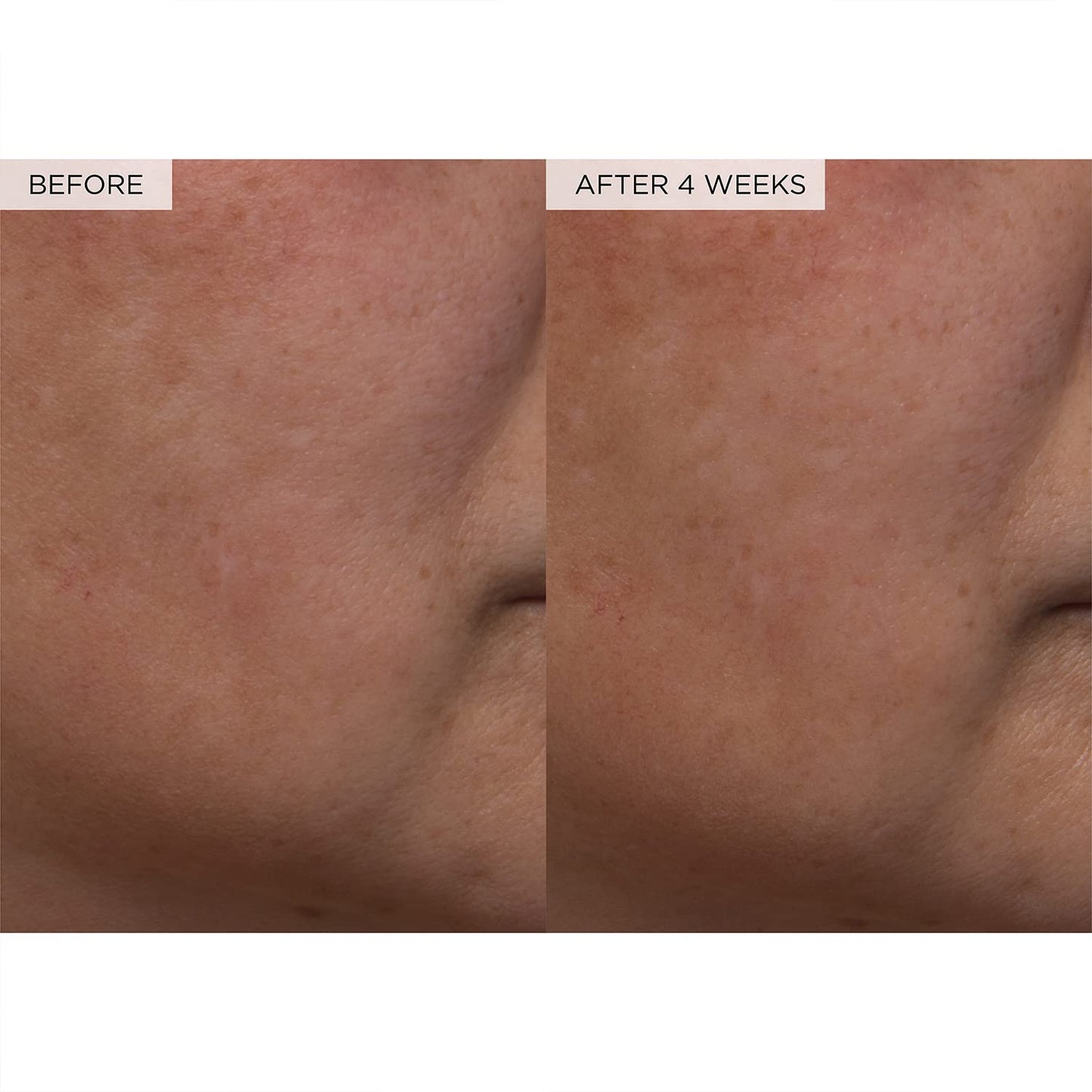 PHA + BHA Face Toner - Korean Skin Care Pore Minimizer & Gentle Facial Exfoliator for Tightening, Hydrating & Exfoliating - Glycerin, Watermelon & Cactus Water (150Ml)