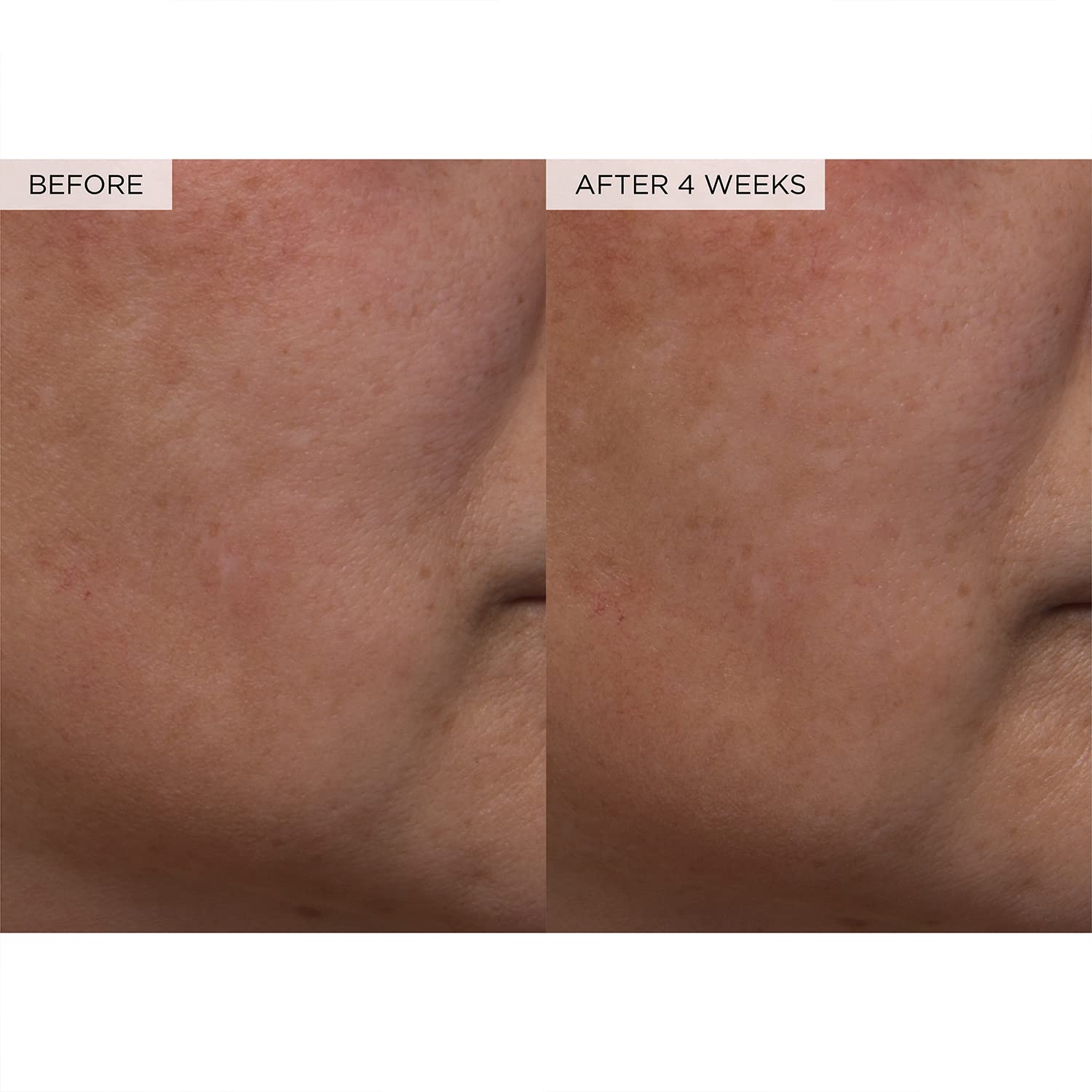 PHA + BHA Face Toner - Korean Skin Care Pore Minimizer & Gentle Facial Exfoliator for Tightening, Hydrating & Exfoliating - Glycerin, Watermelon & Cactus Water (150Ml)