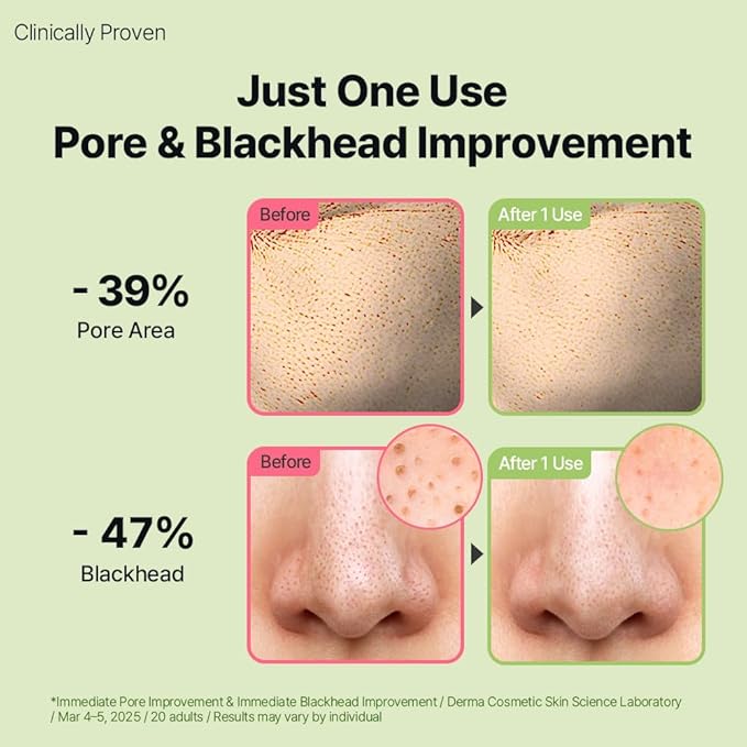 HYCICA Soothing Pore Cleansing Oil | Non-Comedogenic Makeup Blackhead Remover for Sensitive Skin with 7 CICA & 10 HA, Deep Pore Cleanser, Double Cleansing, Korean Skincare, 6.76 fl oz