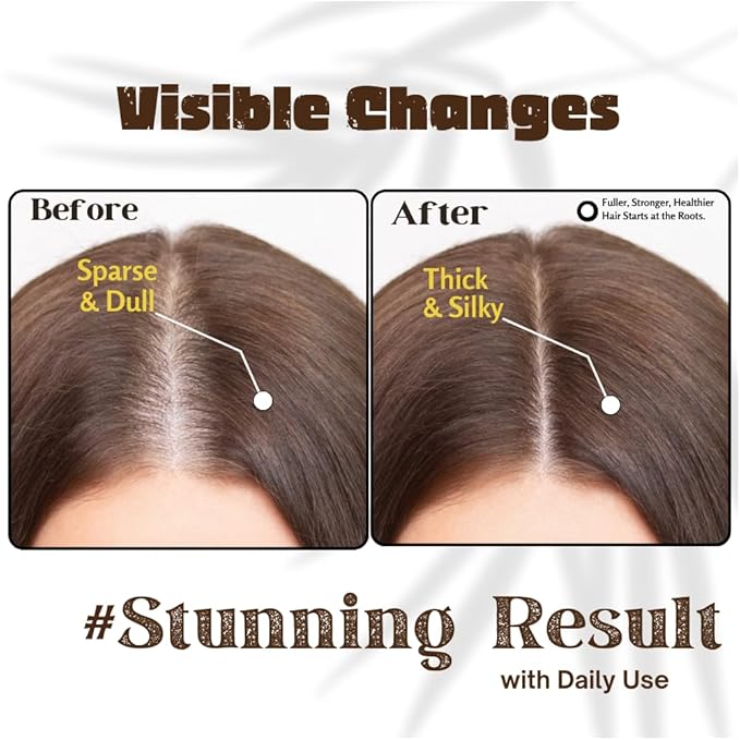 Rosemary Oil For Hair Growth (3.4 Fl Oz) Infused With Biotin, Vitamin E, Almond Oil & Coconut - Hair Strengthening, Nourishing & Volumizing